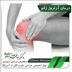 درمان آرتروز