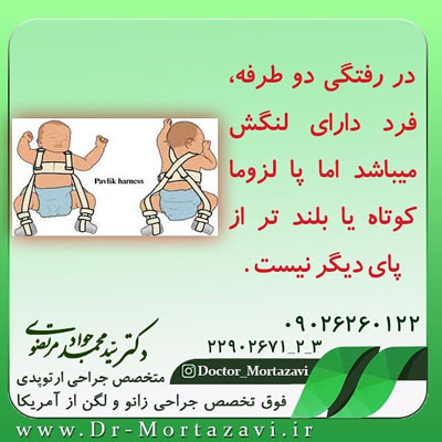 دررفتگی-دو-طرفه-لگن