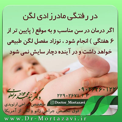 در-رفتگی-مادرزادی-لگن