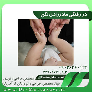 در-رفتگی-مادرزادی-لگن