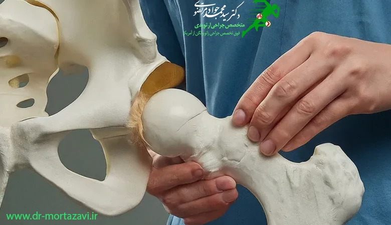 مراقبتهای بعد از تعویض مفصل لگن