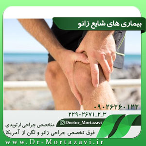 بیماری-های-شایع-زانو