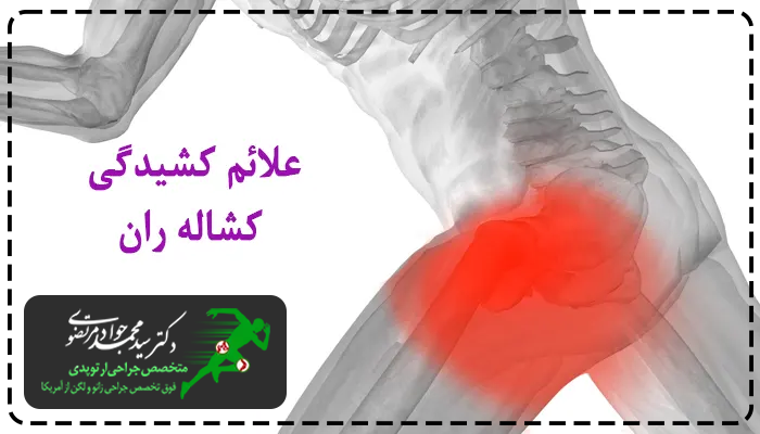 علائم کشیدگی کشاله ران