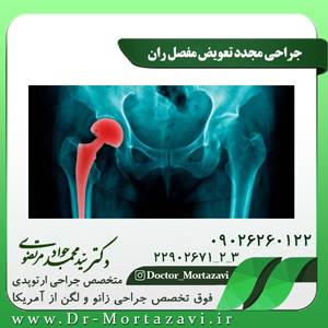 جراحی مجدد تعویض مفصل ران