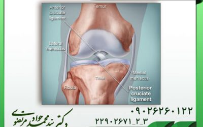 بازسازی رباط های زانو
