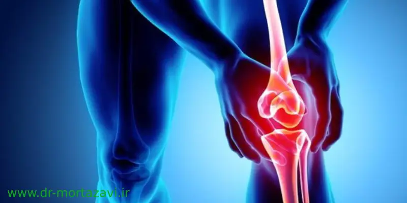 چه روش‌هایی برای پیشگیری از پارگی رباط صلیبی وجود دارد؟